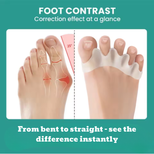 ProStepz Toe Separator